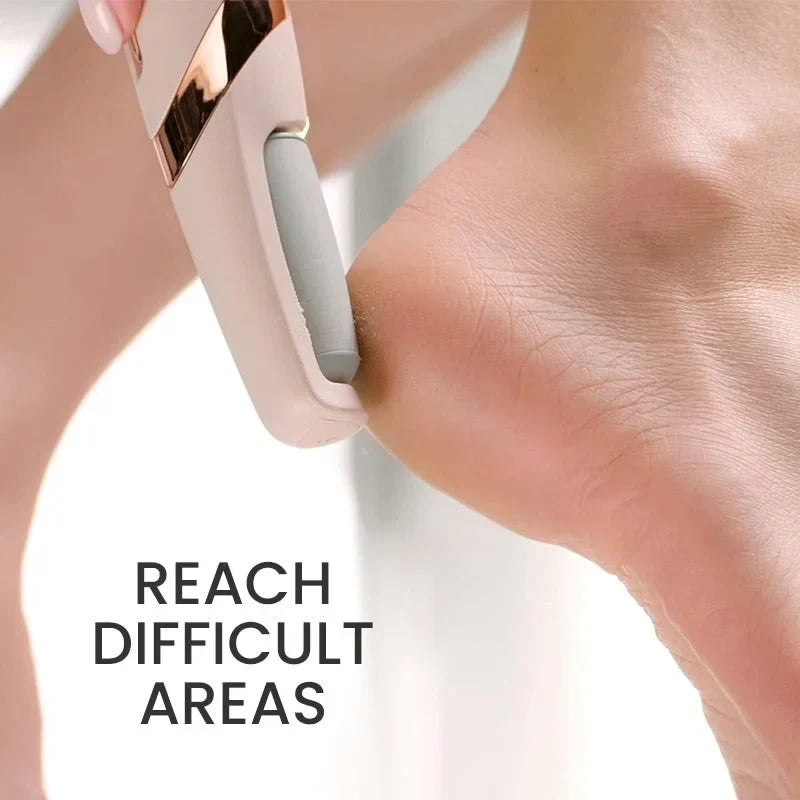 Electric Foot Callus Remover